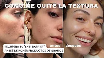 ¿Cómo quitar la textura de la piel? DETOX + RUTINA de skincare para eliminar textura | Anna Sarelly